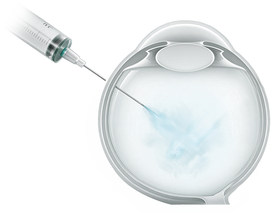 Traditional eye injection